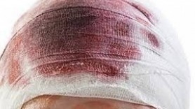 O femeie s-a ales cu capul spart după ce a fost lovită de o maşină pe zebră